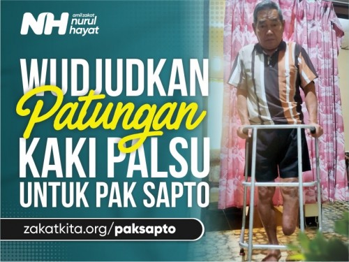 Wujudkan Kaki Palsu untuk Pak Sapto