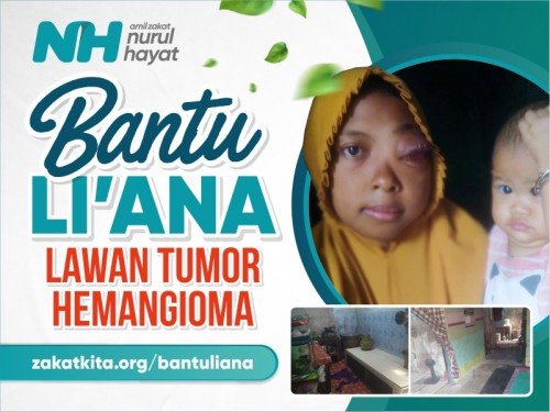 Bantu Li&rsquo;ana Bertahan Melawan Tumor Hemangioma