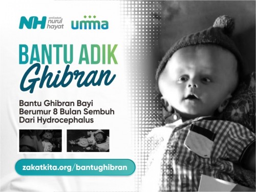 Umma Bantu Perjuangan Bayi Ghibran (Penderita Hidrosefalus)